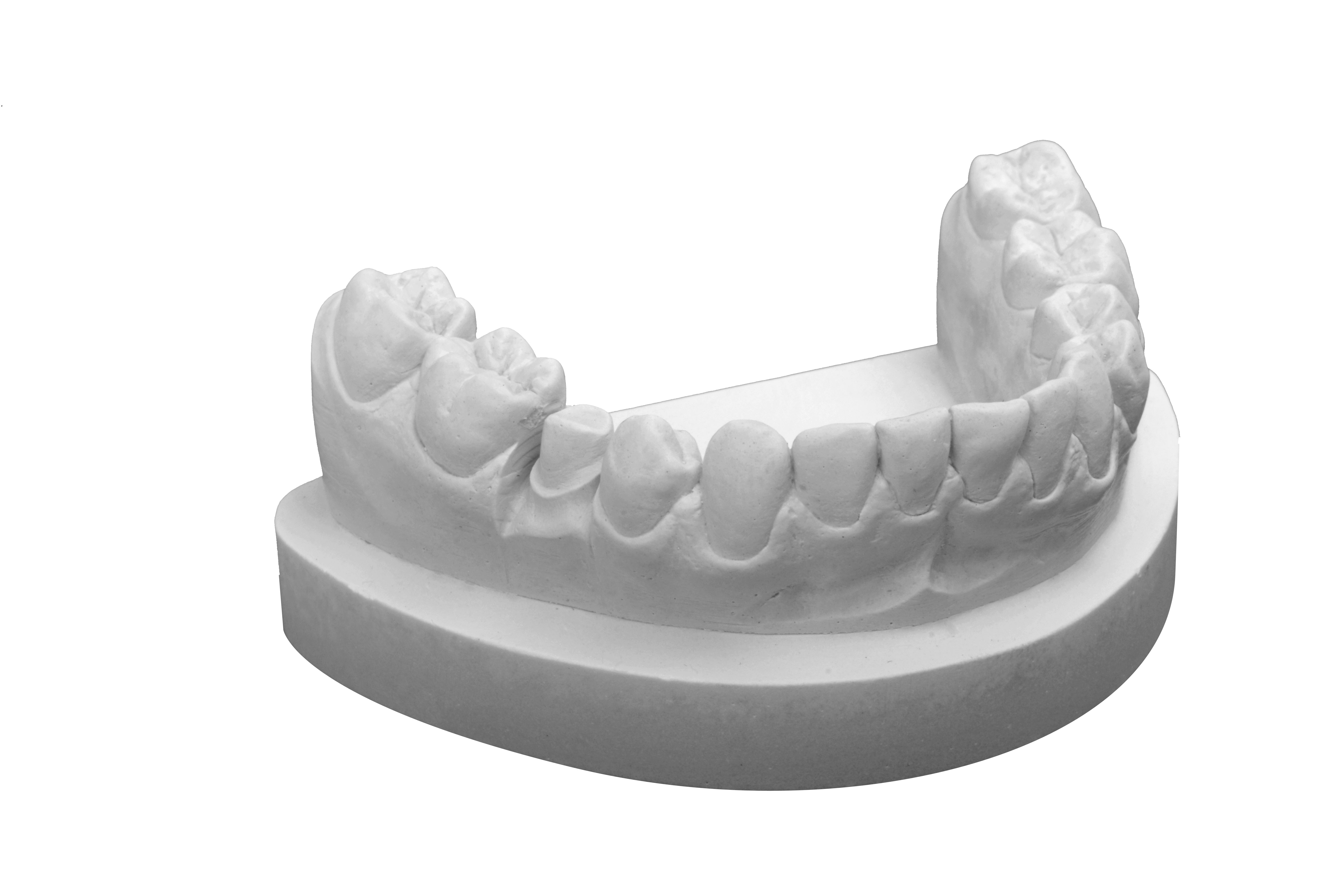 RockStar® lichtgrau 5 kg