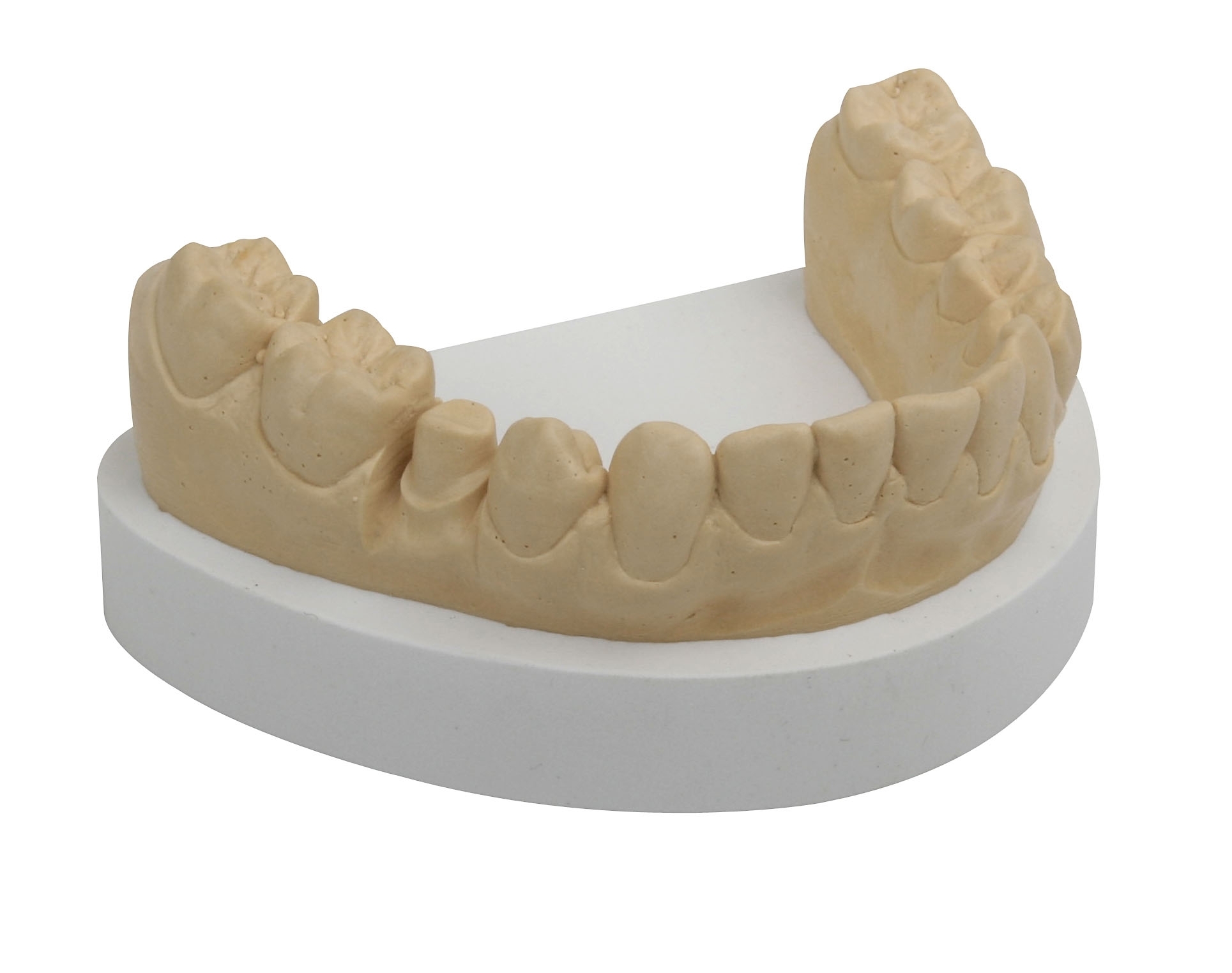 RockStar® gold 5 kg