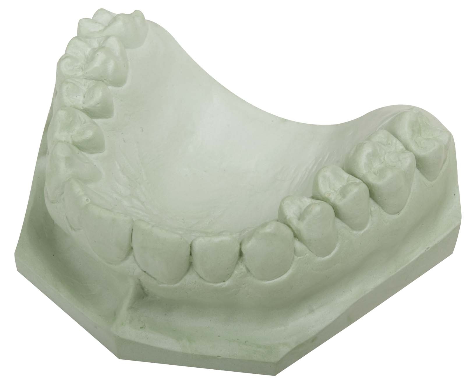 Green STAR 25 kg (Karton)